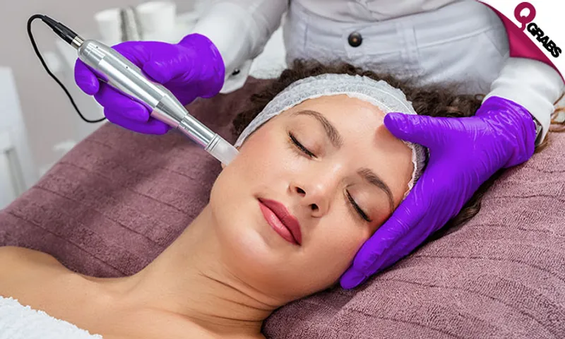 Face Treatments: Microdermabrasion, Chemical Peel, Microneedling & More!